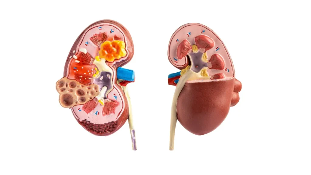 Chronic Kidney Disease