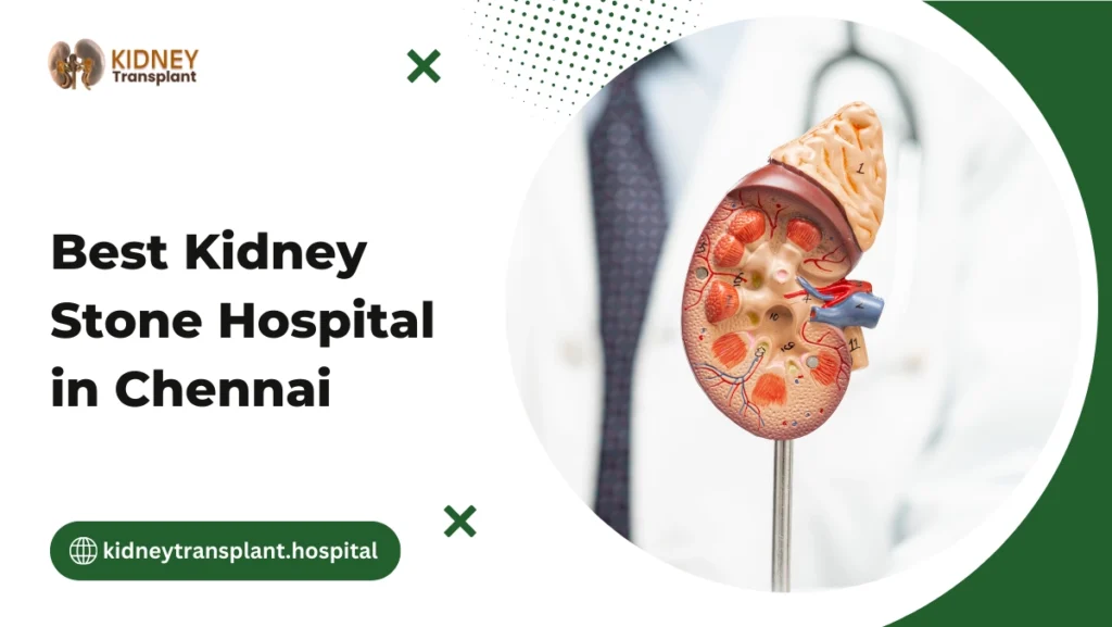 Best Kidney Stone Hospital in Chennai