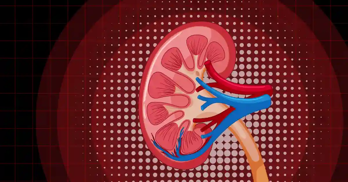 ABO Incompatible Kidney Transplant