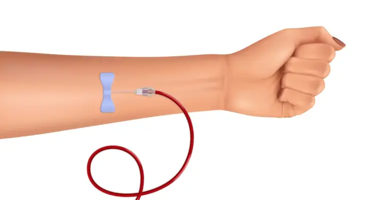 Deceased Donor Transplant