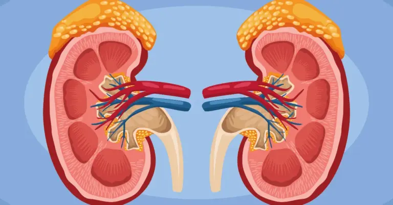 Peritoneal Dialysis