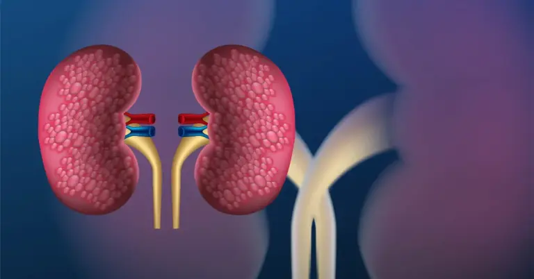 Polycystic Kidney Disease