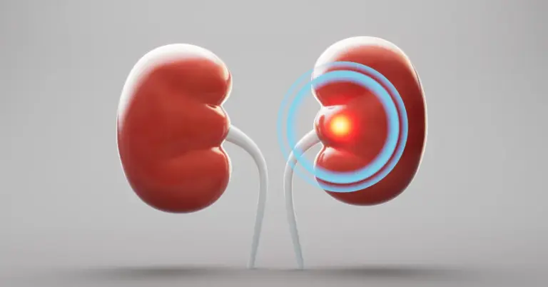 Kidney Disease Symptoms