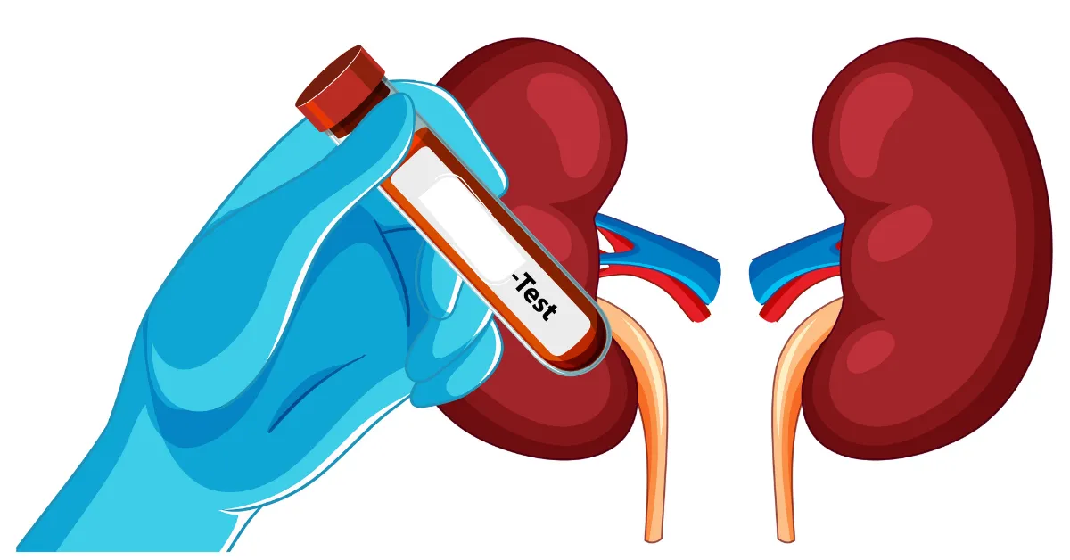 Kidney Tests and Procedures