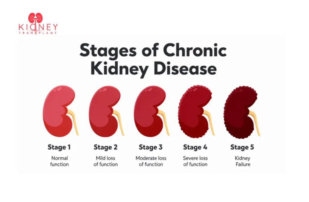 Can Kidney Disease Be Reversed 